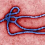 Ebola-Virus